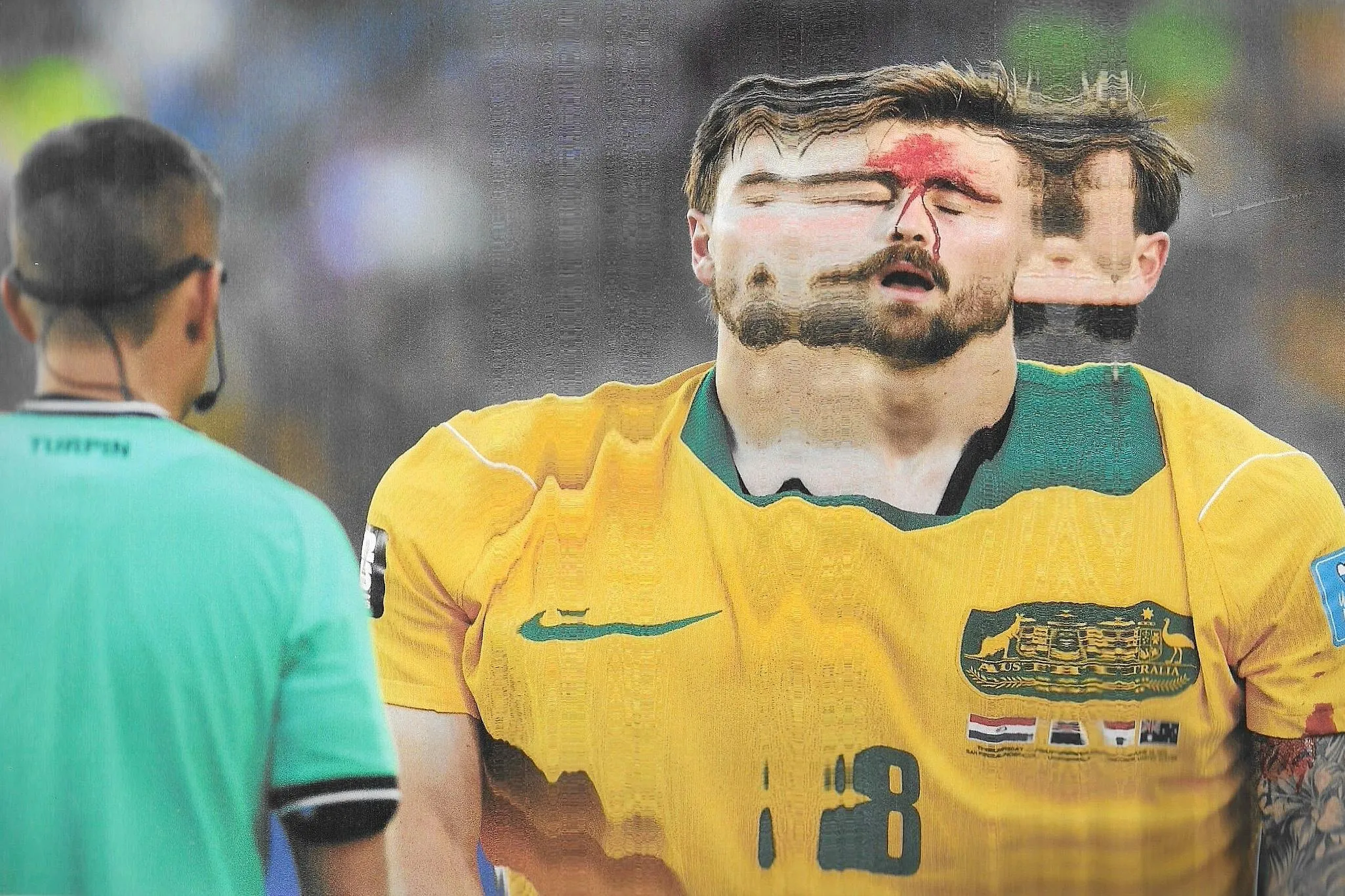 A bloodied Connor Metcalfe. Original photograph by Stu Forster.
